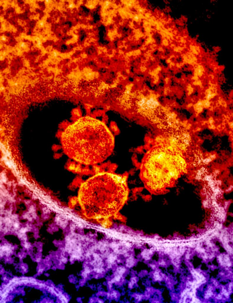 Hantavirus: Unveiling the Silent Threat in the Dust